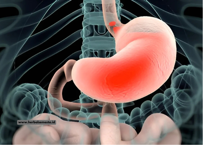 5 Tanda Kesehatan Lambung Menurun yang Perlu Diwaspadai
